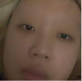 이영지 입원(사진=이영지 인스타그램